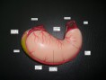 /album/fotogaleria-rotuladas/estomago-jpg2/